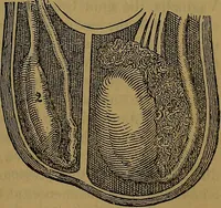 An illustration from The origin of life and process of reproduction in plants and animals : with the anatomy and physiology of the human generative system, male and female, and the causes, prevention and cure of the special diseases to which it is liable : a plain, practical treatise, for popular use / by Dr. F. Hollick ; illustrated by engravings and colored plates. (1902)