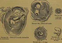 Picture 139 of 163 from The origin of life and process of reproduction in plants and animals : with the anatomy and physiology of the human generative system, male and female, and the causes, prevention and cure of the special diseases to which it is liable : a plain, practical treatise, for popular use / by Dr. F. Hollick ; illustrated by engravings and colored plates. (1902), leaf 867