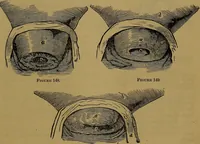 Picture 140 of 163 from The origin of life and process of reproduction in plants and animals : with the anatomy and physiology of the human generative system, male and female, and the causes, prevention and cure of the special diseases to which it is liable : a plain, practical treatise, for popular use / by Dr. F. Hollick ; illustrated by engravings and colored plates. (1902), leaf 877