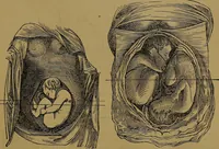 Picture 143 of 163 from The origin of life and process of reproduction in plants and animals : with the anatomy and physiology of the human generative system, male and female, and the causes, prevention and cure of the special diseases to which it is liable : a plain, practical treatise, for popular use / by Dr. F. Hollick ; illustrated by engravings and colored plates. (1902), leaf 887
