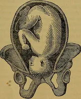 An illustration from The origin of life and process of reproduction in plants and animals : with the anatomy and physiology of the human generative system, male and female, and the causes, prevention and cure of the special diseases to which it is liable : a plain, practical treatise, for popular use / by Dr. F. Hollick ; illustrated by engravings and colored plates. (1902)