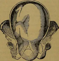 An illustration from The origin of life and process of reproduction in plants and animals : with the anatomy and physiology of the human generative system, male and female, and the causes, prevention and cure of the special diseases to which it is liable : a plain, practical treatise, for popular use / by Dr. F. Hollick ; illustrated by engravings and colored plates. (1902)