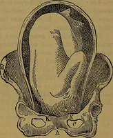 Picture 150 of 163 from The origin of life and process of reproduction in plants and animals : with the anatomy and physiology of the human generative system, male and female, and the causes, prevention and cure of the special diseases to which it is liable : a plain, practical treatise, for popular use / by Dr. F. Hollick ; illustrated by engravings and colored plates. (1902), leaf 907