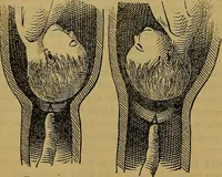 An illustration from The origin of life and process of reproduction in plants and animals : with the anatomy and physiology of the human generative system, male and female, and the causes, prevention and cure of the special diseases to which it is liable : a plain, practical treatise, for popular use / by Dr. F. Hollick ; illustrated by engravings and colored plates. (1902)