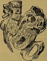 Picture 157 of 163 from The origin of life and process of reproduction in plants and animals : with the anatomy and physiology of the human generative system, male and female, and the causes, prevention and cure of the special diseases to which it is liable : a plain, practical treatise, for popular use / by Dr. F. Hollick ; illustrated by engravings and colored plates. (1902), leaf 948