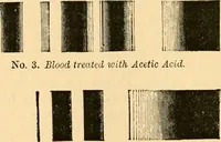 An illustration from The microscope : its history, construction, and application, being a familiar introduction to the use of the instrument, and the study of microscopial science / By Jabez Hogg ... with upwards of five hundred engravings and coloured illustrations by Tuffen West. (1867)
