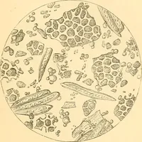 An illustration from The microscope : its history, construction, and application, being a familiar introduction to the use of the instrument, and the study of microscopial science / By Jabez Hogg ... with upwards of five hundred engravings and coloured illustrations by Tuffen West. (1867)