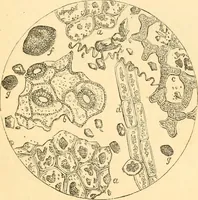 An illustration from The microscope : its history, construction, and application, being a familiar introduction to the use of the instrument, and the study of microscopial science / By Jabez Hogg ... with upwards of five hundred engravings and coloured illustrations by Tuffen West. (1867)