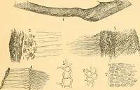 An illustration from The microscope : its history, construction, and application, being a familiar introduction to the use of the instrument, and the study of microscopial science / By Jabez Hogg ... with upwards of five hundred engravings and coloured illustrations by Tuffen West. (1867)