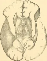 An illustration from The mysteries of human nature explained by a new system of nervous physiology : to which is added, a review of the errors of spiritualism, and instructions for developing or resisting the influence by which subjects and mediums are made / by J. Stanley Grimes. (1860)