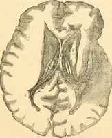 An illustration from The mysteries of human nature explained by a new system of nervous physiology : to which is added, a review of the errors of spiritualism, and instructions for developing or resisting the influence by which subjects and mediums are made / by J. Stanley Grimes. (1860)