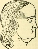 An illustration from Phrenology proved, illustrated, and applied : embracing an analysis of the primary mental powers in their various degrees of developments, the phenomena produced by their combined activity, and the location of the phrenological organs in the head : together with a view of the moral and anatomical objections to the science / by O. S. and L. N. Fowler. (1892)
