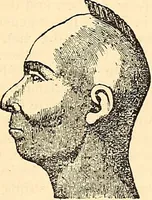 An illustration from Phrenology proved, illustrated, and applied : embracing an analysis of the primary mental powers in their various degrees of developments, the phenomena produced by their combined activity, and the location of the phrenological organs in the head : together with a view of the moral and anatomical objections to the science / by O. S. and L. N. Fowler. (1892)