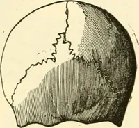 An illustration from Phrenology proved, illustrated, and applied : embracing an analysis of the primary mental powers in their various degrees of developments, the phenomena produced by their combined activity, and the location of the phrenological organs in the head : together with a view of the moral and anatomical objections to the science / by O. S. and L. N. Fowler. (1892)