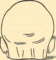 An illustration from Phrenology proved, illustrated, and applied : embracing an analysis of the primary mental powers in their various degrees of developments, the phenomena produced by their combined activity, and the location of the phrenological organs in the head : together with a view of the moral and anatomical objections to the science / by O. S. and L. N. Fowler. (1892)