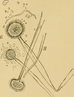 An illustration from Diseases of the ear : a text-book for practitioners and students of medicine / by Edward Bradford Dench. (1900)
