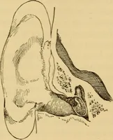 Picture 38 of 45 from Diseases of the ear : a text-book for practitioners and students of medicine / by Edward Bradford Dench. (1900), leaf 310