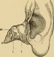 An illustration from Diseases of the ear : a text-book for practitioners and students of medicine / by Edward Bradford Dench. (1900)