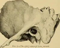 Picture 4 of 45 from Diseases of the ear : a text-book for practitioners and students of medicine / by Edward Bradford Dench. (1900), leaf 40