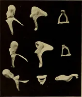 An illustration from Diseases of the ear : a text-book for practitioners and students of medicine / by Edward Bradford Dench. (1900)