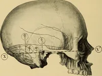 An illustration from Diseases of the ear : a text-book for practitioners and students of medicine / by Edward Bradford Dench. (1900)