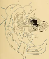 Picture 9 of 45 from Diseases of the ear : a text-book for practitioners and students of medicine / by Edward Bradford Dench. (1900), leaf 63