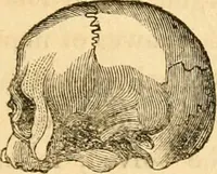 An illustration from A system of phrenology / by George Combe. (1830)