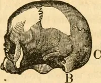 An illustration from A system of phrenology / by George Combe. (1830)