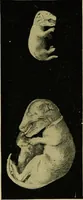 An illustration from Diseases of infants and children / by Henry Dwight Chapin and Godfrey Roger Pisek ; with 181 ill. and eleven colored plates. (1911)