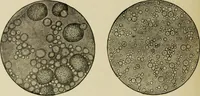 An illustration from Diseases of infants and children / by Henry Dwight Chapin and Godfrey Roger Pisek ; with 181 ill. and eleven colored plates. (1911)