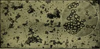 An illustration from Diseases of infants and children / by Henry Dwight Chapin and Godfrey Roger Pisek ; with 181 ill. and eleven colored plates. (1911)
