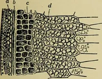 An illustration from Diseases of infants and children / by Henry Dwight Chapin and Godfrey Roger Pisek ; with 181 ill. and eleven colored plates. (1911)