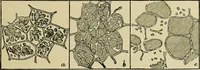 An illustration from Diseases of infants and children / by Henry Dwight Chapin and Godfrey Roger Pisek ; with 181 ill. and eleven colored plates. (1911)