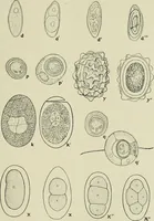 Picture 38 of 64 from Diseases of infants and children / by Henry Dwight Chapin and Godfrey Roger Pisek ; with 181 ill. and eleven colored plates. (1911), leaf 267
