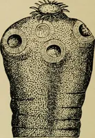 An illustration from Diseases of infants and children / by Henry Dwight Chapin and Godfrey Roger Pisek ; with 181 ill. and eleven colored plates. (1911)