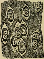 An illustration from Diseases of infants and children / by Henry Dwight Chapin and Godfrey Roger Pisek ; with 181 ill. and eleven colored plates. (1911)
