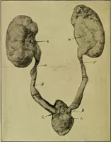 An illustration from Diseases of infants and children / by Henry Dwight Chapin and Godfrey Roger Pisek ; with 181 ill. and eleven colored plates. (1911)