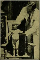 An illustration from Diseases of infants and children / by Henry Dwight Chapin and Godfrey Roger Pisek ; with 181 ill. and eleven colored plates. (1911)