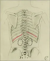 An illustration from Diseases of infants and children / by Henry Dwight Chapin and Godfrey Roger Pisek ; with 181 ill. and eleven colored plates. (1911)