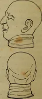 An illustration from Illustrations of phrenology : being a selection of articles from the Edinburg phrenological journal, and the transactions of the Edinburg Phrenological Society. With twenty-six wood cuts / Ed. by George H. Calvert. With an introduction by the editor. (1832)