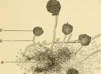 An illustration from A manual of otology / By Gorham Bacon ... With an introductory chapter by Clarence John Blake ... With 110 illustrations and a colored plate. (1898)