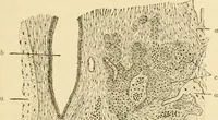 An illustration from A manual of otology / By Gorham Bacon ... With an introductory chapter by Clarence John Blake ... With 110 illustrations and a colored plate. (1898)
