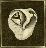 An illustration from A manual of otology / By Gorham Bacon ... With an introductory chapter by Clarence John Blake ... With 110 illustrations and a colored plate. (1898)