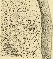 An illustration from A manual of otology / By Gorham Bacon ... With an introductory chapter by Clarence John Blake ... With 110 illustrations and a colored plate. (1898)