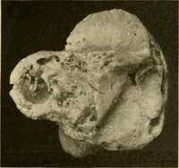 An illustration from A manual of otology / By Gorham Bacon ... With an introductory chapter by Clarence John Blake ... With 110 illustrations and a colored plate. (1898)