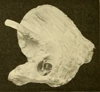 An illustration from A manual of otology / By Gorham Bacon ... With an introductory chapter by Clarence John Blake ... With 110 illustrations and a colored plate. (1898)
