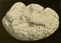 An illustration from A manual of otology / By Gorham Bacon ... With an introductory chapter by Clarence John Blake ... With 110 illustrations and a colored plate. (1898)