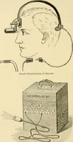 An illustration from A manual of otology / By Gorham Bacon ... With an introductory chapter by Clarence John Blake ... With 110 illustrations and a colored plate. (1898)