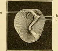 An illustration from A manual of otology / By Gorham Bacon ... With an introductory chapter by Clarence John Blake ... With 110 illustrations and a colored plate. (1898)
