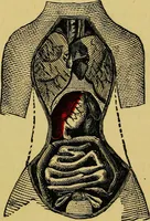 An illustration from Ladies' guide in health and disease : girlhood, maidenhood, wifehood, motherhood / by J.H. Kellogg. (1892)